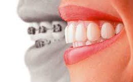 images-4