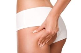 offerta-deal-cavitazioni-radiofrequenza-corpo-400x264